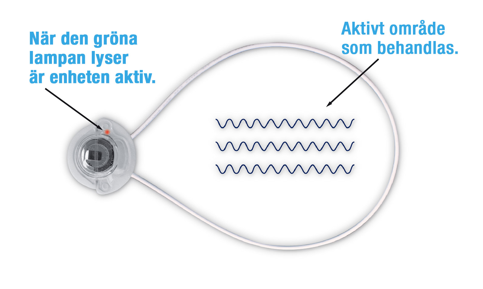 Om kläderna inte är för tjocka kan ActiPatch-enheten även appliceras utanpå kläderna.